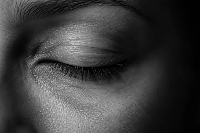 Unterlidstraffung — Clinic Selnau Zürich