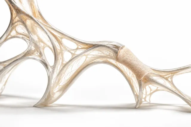 Wann braucht man bei einer Nasenrevision Rippenknorpel? — Clinic Selnau Zürich